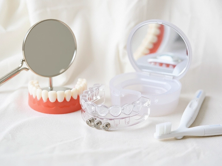 Avantages et inconvénients des aligneurs Invisalign