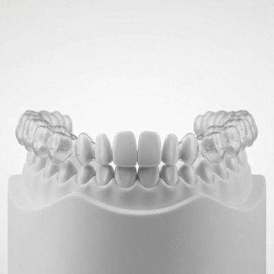 Close-up of clear aligners on a dental model